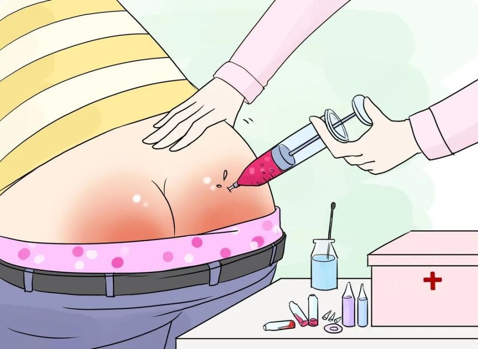 打黄体酮针后有硬结怎么办