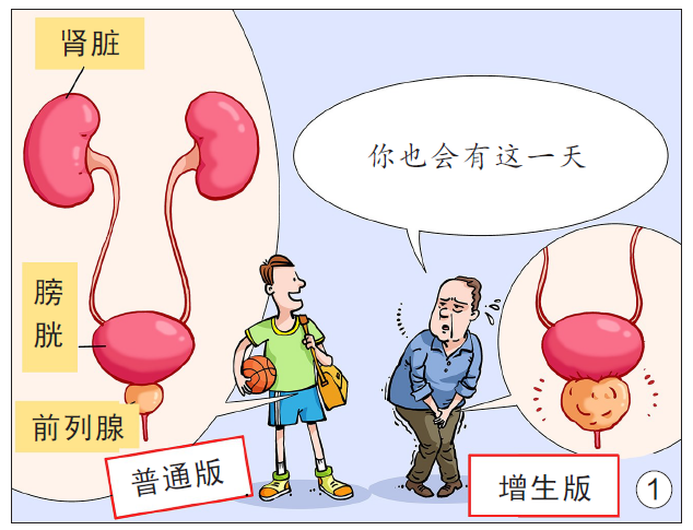 前列腺也会“发福”