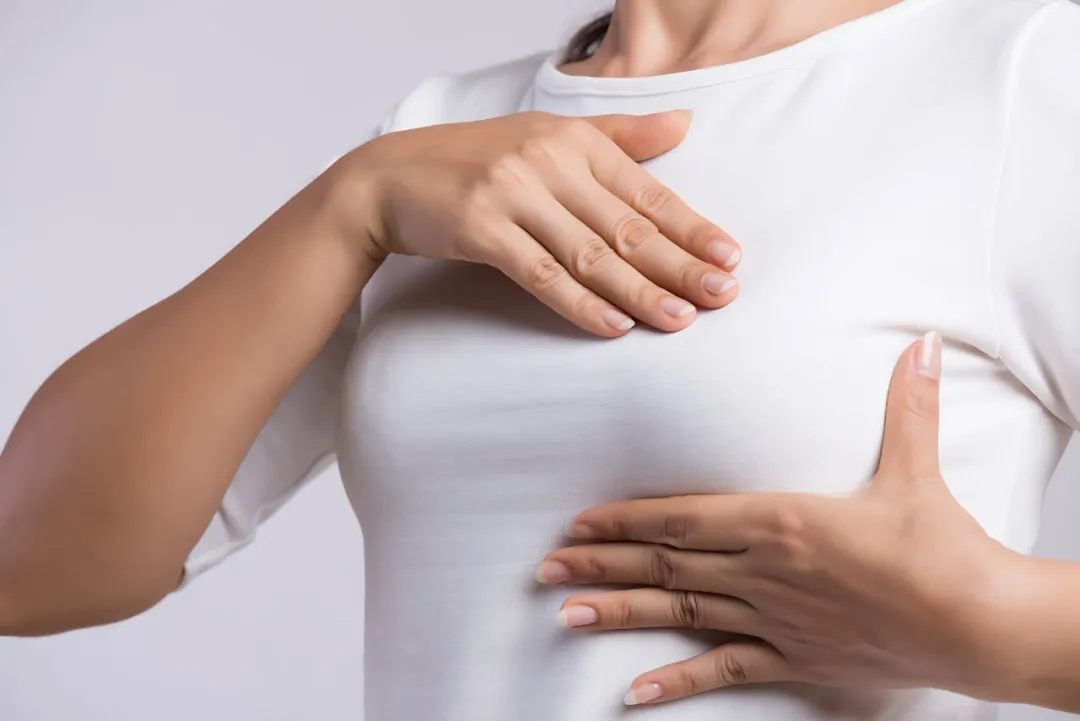 乳癌偏爱痰湿体质